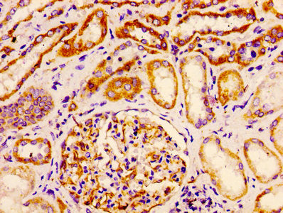 Immunohistochemistry of paraffin-embedded human kidney tissue using CSB-PA10857A0Rb at dilution of 1:100