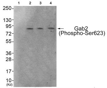 Western blot analysis of extracts from 293 cells (Lane 2), HeLa cells (Lane 3) and HepG2 cells (Lane 4), using Gab2 (Phospho-Ser623) Antibody. The lane on the left is treated with antigen-specific peptide.