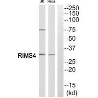 Western blot analysis of extracts from JK cells and Hela cells, using RIMS4 antiobdy.