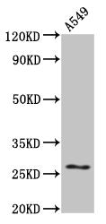 Western Blot Positive WB detected in: A549 whole cell lysate All lanes: HSPB1 antibody at 4ug/ml Secondary Goat polyclonal to rabbit IgG at 1/50000 dilution Predicted band size: 23 kDa Observed band size: 27 kDa