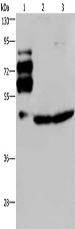 Gel: 8%SDS-PAGE, Lysate: 40 ug, Lane 1-3: Human rectal cancer tissue, Jurkat cells, HT29 cells, Primary antibody: CSB-PA108805(PCSK9 Antibody) at dilution 1/200, Secondary antibody: Goat anti rabbit IgG at 1/8000 dilution, Exposure time: 1 minute