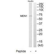 Western blot analysis of extracts from HuvEc cells, using MEN1 antibody.