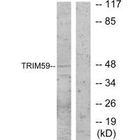 Western blot analysis of extracts from NIH-3T3 cells, using TRIM59 antibody.