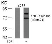 Western blot analysis of extracts from MCF cells untreated or treated with EGF using p70 S6 Kinase(Phospho-Ser424) Antibody.