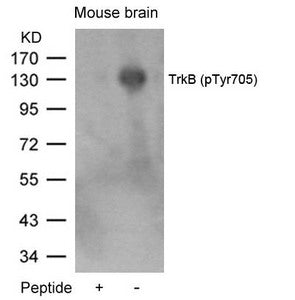 Western blot analysis of extracts from mouse brain tissue using TrkB(Phospho-Tyr705) Antibody and the same antibody preincubated with blocking peptide.