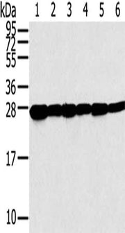 Gel: 12%SDS-PAGE, Lysate: 40 ug, Lane 1-6: Human normal liver tissue, A549 cells, human fetal liver tissue, hepg2 cells, hela cells, human placenta tissue, Primary antibody: CSB-PA109245(SNAP23 Antibody) at dilution 1/200, Secondary antibody: Goat...