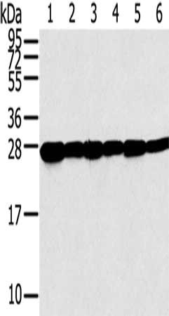 Gel: 12%SDS-PAGE, Lysate: 40 ug, Lane 1-6: Human normal liver tissue, A549 cells, human fetal liver tissue, hepg2 cells, hela cells, human placenta tissue, Primary antibody: CSB-PA109245(SNAP23 Antibody) at dilution 1/200, Secondary antibody: Goat...