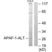 Western blot analysis of extracts from COLO205, using APAF-1-ALT antibody.