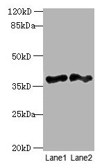 Western blot All lanes: DNAJB4 antibody at 2µg/ml Lane 1: Hela whole cell lysate Lane 2: Mouse heart tissue Secondary Goat polyclonal to rabbit IgG at 1/10000 dilution Predicted band size: 38 kDa Observed band size: 38 kDa