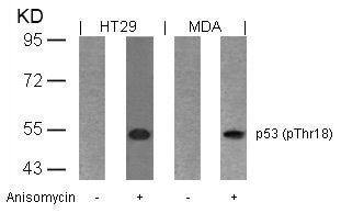 Western blot analysis of extracts from HT29 and MDA cells untreated or treated with anisomycin using p53(Phospho-Thr18) Antibody.