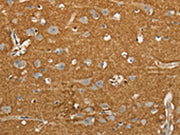 The image on the left is immunohistochemistry of paraffin-embedded Human brain tissue using CSB-PA109577(SLC1A2 Antibody) at dilution 1/20, on the right is treated with synthetic peptide. (Original magnification: ×200)