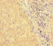 Immunohistochemistry of paraffin-embedded human liver tissue using CSB-PA10964A0Rb at dilution of 1:100