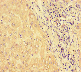 Immunohistochemistry of paraffin-embedded human liver tissue using CSB-PA10964A0Rb at dilution of 1:100