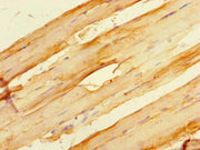 Immunohistochemistry of paraffin-embedded human skeletal muscle tissue using CSB-PA10979A0Rb at dilution of 1:100