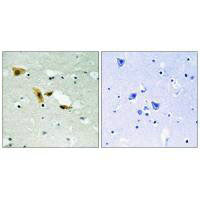 Immunohistochemistry analysis of paraffin-embedded human brain tissue using APLF (Ab-116) antibody.