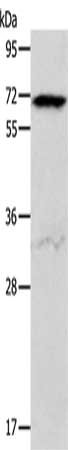 Gel: 10%SDS-PAGE, Lysate: 40 ug, Lane: Hela cells, Primary antibody: CSB-PA110386(ACVR2A Antibody) at dilution 1/400, Secondary antibody: Goat anti rabbit IgG at 1/8000 dilution, Exposure time: 10 seconds
