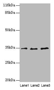 Western blot All lanes: AZGP1 antibody at 4µg/ml Lane 1: PC-3 whole cell lysate Lane 2: HepG2 whole cell lysate Lane 3: K562 whole cell lysate Secondary Goat polyclonal to rabbit IgG at 1/10000 dilution Predicted band size: 35 kDa Observed band si...
