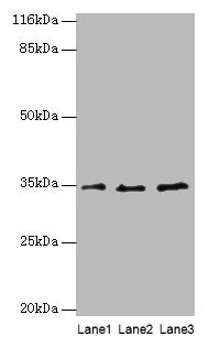 Western blot All lanes: AZGP1 antibody at 4µg/ml Lane 1: PC-3 whole cell lysate Lane 2: HepG2 whole cell lysate Lane 3: K562 whole cell lysate Secondary Goat polyclonal to rabbit IgG at 1/10000 dilution Predicted band size: 35 kDa Observed band si...