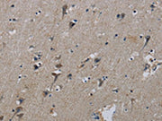 The image on the left is immunohistochemistry of paraffin-embedded Human brain tissue using CSB-PA110424(PIK3CB Antibody) at dilution 1/50, on the right is treated with synthetic peptide. (Original magnification: ×200)