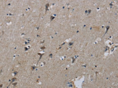 The image on the left is immunohistochemistry of paraffin-embedded Human brain tissue using CSB-PA110424(PIK3CB Antibody) at dilution 1/50, on the right is treated with synthetic peptide. (Original magnification: ×200)