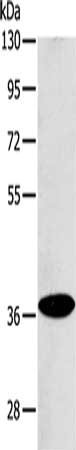Gel: 10%SDS-PAGE, Lysate: 40 ug, Lane: Raji cells, Primary antibody: CSB-PA110589(ACMSD Antibody) at dilution 1/400, Secondary antibody: Goat anti rabbit IgG at 1/8000 dilution, Exposure time: 20 seconds