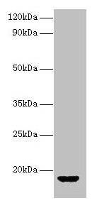 Western blot All lanes: AVP antibody at 2µg/ml + Rat gonadal tissue Secondary Goat polyclonal to rabbit IgG at 1/10000 dilution Predicted band size: 18 kDa Observed band size: 18 kDa