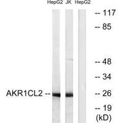 Western blot analysis of extracts from HepG2 cells and Jurkat cells, using AKR1CL2 antibody.