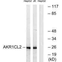 Western blot analysis of extracts from HepG2 cells and Jurkat cells, using AKR1CL2 antibody.