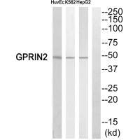 Western blot analysis of extracts from HuvEc cells,K562 cells and HepG2 cells, using GPRIN2 antiobdy.
