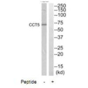 Western blot analysis of extracts from HepG2 cells, using CCT5 antibody.