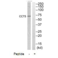 Western blot analysis of extracts from HepG2 cells, using CCT5 antibody.