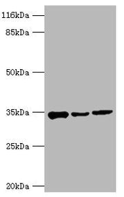 Western blot All lanes: AQP4 antibody at 2µg/ml Lane 1: Mouse heart tissue Lane 2: Mouse brain tissue Lane 3: Mouse kidney tissue Secondary Goat polyclonal to rabbit IgG at 1/10000 dilution Predicted band size: 35, 33 kDa Observed band size: 35 kDa