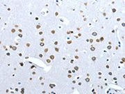 The image on the left is immunohistochemistry of paraffin-embedded Human brain tissue using CSB-PA111496(ACE2 Antibody) at dilution 1/30, on the right is treated with fusion protein. (Original magnification: ×200)