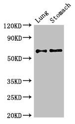 Western Blot Positive WB detected in: Mouse lung tissue, Mouse stomach tissue All lanes: GAD2 antibody at 2.7ug/ml Secondary Goat polyclonal to rabbit IgG at 1/50000 dilution Predicted band size: 66 kDa Observed band size: 66 kDa