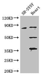 Western Blot Positive WB detected in: SH-SY5Y whole cell lysate, Mouse heart tissue All lanes: MAPT antibody at 3.25ug/ml Secondary Goat polyclonal to rabbit IgG at 1/50000 dilution Predicted band size: 79, 37, 33, 40, 43, 41, 46, 81 kDa Observed...