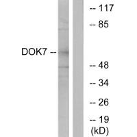 Western blot analysis of extracts from mouse brain cells, using DOK7 antibody.