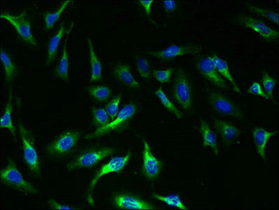 Immunofluorescent analysis of Hela cells using CSB-PA11189A0Rb at dilution of 1:100 and Alexa Fluor 488-congugated AffiniPure Goat Anti-Rabbit IgG(H+L)