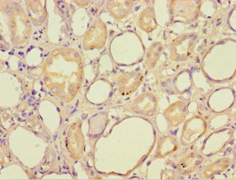 Immunohistochemistry of paraffin-embedded human kidney tissue using CSB-PA11195A0Rb at dilution of 1:100