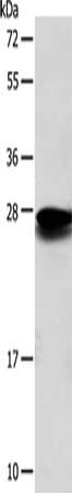 Gel: 12%SDS-PAGE, Lysate: 40 ug, Lane: Mouse liver tissue, Primary antibody: CSB-PA112138(SOD2 Antibody) at dilution 1/650, Secondary antibody: Goat anti rabbit IgG at 1/8000 dilution, Exposure time: 30 seconds