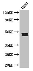 Western Blot Positive WB detected in: U251 whole cell lysate All lanes: SERPINE1 antibody at 2.5µg/ml Secondary Goat polyclonal to rabbit IgG at 1/50000 dilution Predicted band size: 46, 44 kDa Observed band size: 46, 44 kDa