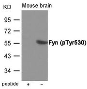 Western blot analysis of extracts from Mouse brain tissue using Fyn (Phospho-Tyr530) Antibody.The lane on the left is treated with the antigen-specific peptide.