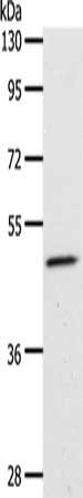 Gel: 10%SDS-PAGE, Lysate: 40 ug, Lane: 231 cells, Primary antibody: CSB-PA112569(PPARA Antibody) at dilution 1/450, Secondary antibody: Goat anti rabbit IgG at 1/8000 dilution, Exposure time: 1 minute