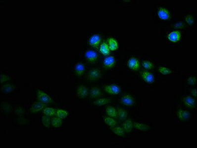 Immunofluorescence staining of Hela cells with CSB-PA11269A0Rb at 1:133, counter-stained with DAPI. The cells were fixed in 4% formaldehyde, permeabilized using 0.2% Triton X-100 and blocked in 10% normal Goat Serum. The cells were then incubated...