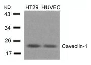 Western blot analysis of extracts from HT29 and HUVEC cells using Caveolin-1(Ab-14) Antibody.