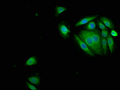 Immunofluorescence staining of A549 cells with CSB-PA11275A0Rb at 1:150, counter-stained with DAPI. The cells were fixed in 4% formaldehyde, permeabilized using 0.2% Triton X-100 and blocked in 10% normal Goat Serum. The cells were then incubated...