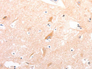 The image on the left is immunohistochemistry of paraffin-embedded Human brain tissue using CSB-PA112790(CELSR2 Antibody) at dilution 1/50, on the right is treated with synthetic peptide. (Original magnification: ×200)