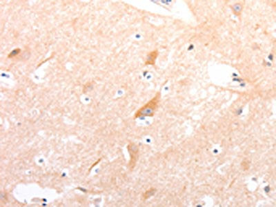 The image on the left is immunohistochemistry of paraffin-embedded Human brain tissue using CSB-PA112790(CELSR2 Antibody) at dilution 1/50, on the right is treated with synthetic peptide. (Original magnification: ×200)