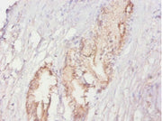 Immunohistochemistry of paraffin-embedded human prostate tissue using CSB-PA11309A0Rb at dilution of 1:20