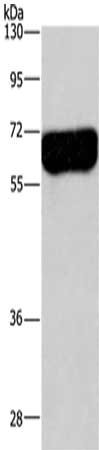 Gel: 8%SDS-PAGE,Lysate: 40 ug,,Primary antibody: CSB-PA113209(DPYSL3 Antibody) at dilution 1/200 dilution,Secondary antibody: Goat anti rabbit IgG at 1/8000 dilution,Exposure time: 2 minutes