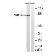 Western blot analysis of extracts from Rat brain cells, using PRKCG(Ab-655) antibody.